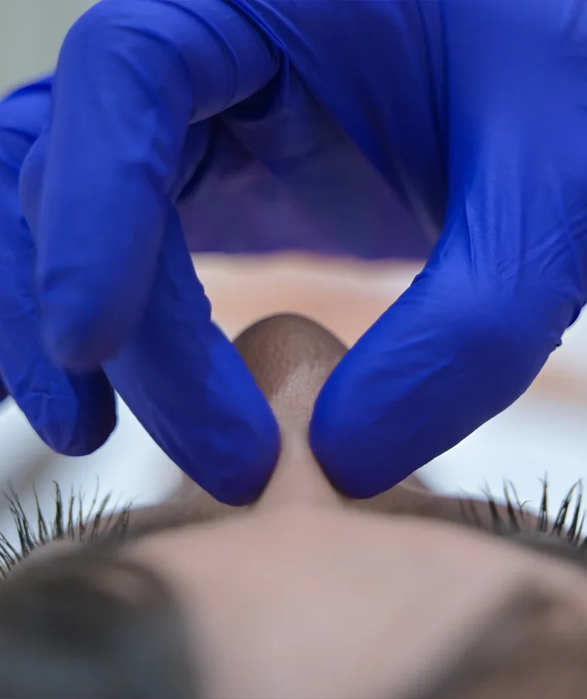 Chirurgia del volto a Bari – Interventi estetici con il Dr. Stefano Lovero